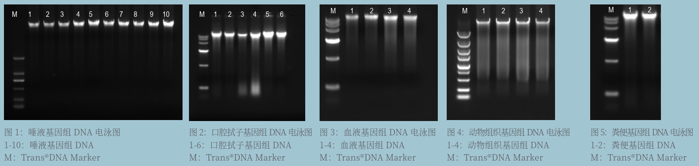 提取试剂盒